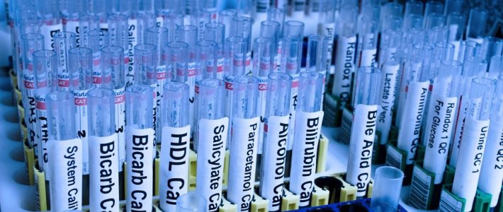 lab test