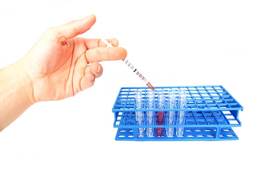 urine analysis