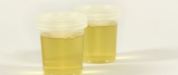 Reminders When Buying a Synthetic Urine kit for Use test urine in container