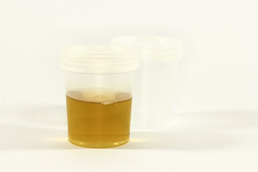 urine test